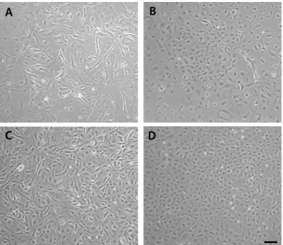 Figure 3.  Phase-contrast  images of  RCECs  with  or  without  ROCK  inhibitor, Y27632 and  hMSC-conditioned  medium