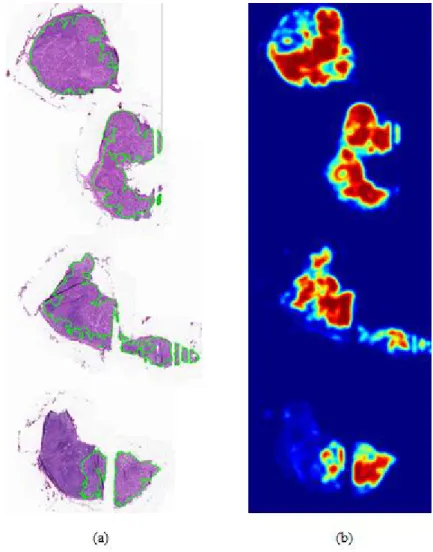 Figure 1-2. An example of the frozen tissues and the corresponding heat maps. (a) WSI with  metastasis regions annotated by boundaries colored at green
