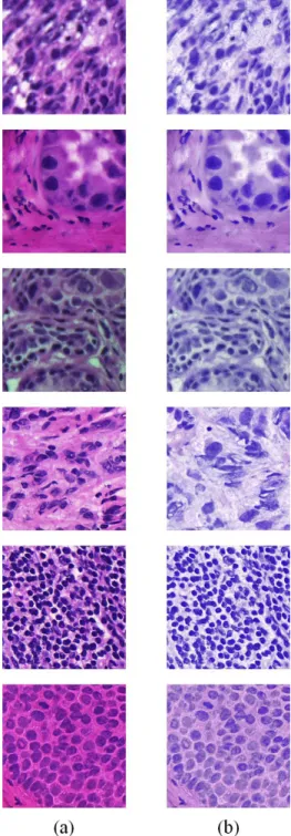 Figure 2-7. An example of stain normalization. (a) Tumor and normal tissue patches showing  color variations, (b) stain normalized patches.