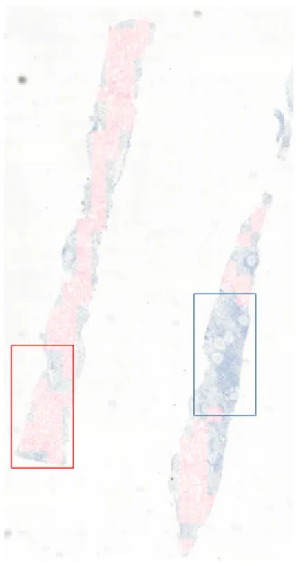 Figure  3-5.  Feasible  and  non-feasible  ROI  classification  results.  Tissues  including feasible  ROIs are colored red