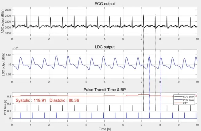 Figure  5.7  shows  a  real-time  operation  of  the  continuous  BP  monitoring  system  in  a  PC  Matlab  interface