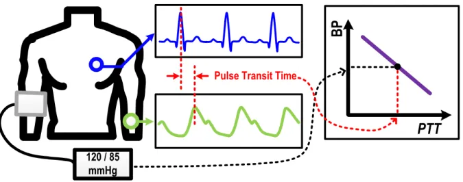 Figure 1.2. Pulse transit time based blood pressure monitoring systemPulse Transit Time