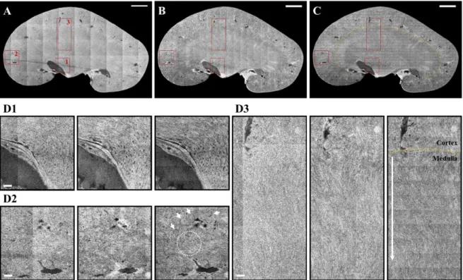 Figure 3-7. Trajectory OCM image of mouse kidney following midsagittal section. (A) 4X, (B) 10X,  and (C) 20X en-face images (orange dot line: boundary between cortex and medulla area) (scale bar: 