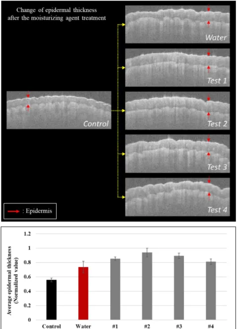 Figure 4-6. Quantitative measurement of the epidermal thickness changes on human skin after the  treatment of moisturizing agents using the skin layer segmentation.