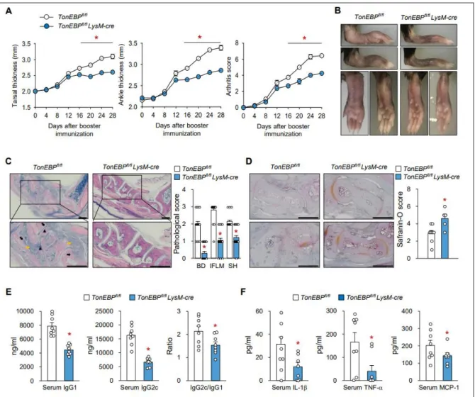 Figure  3-1.  Myeloid  TonEBP  deficiency  reduces  the  severity  of  collagen-induced  arthritis