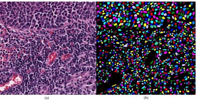 Figure 2: A sample image and label from [4]. There are 1,309 cells in this single 1,000 x 1,000 pathology image.