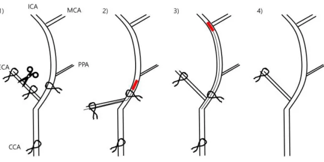 Figure 4. tMCAO surgery with mono-filament