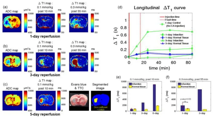 Figure 8. ΔT 1 maps of tMCAO rat depending on reperfusion time or injection dose As shown in Figure 8.a, for 0.1 mmol/kg injection, there were no significant ΔT 1 values between  contralateral hemisphere and infarction, which has low ADC values on ADC map