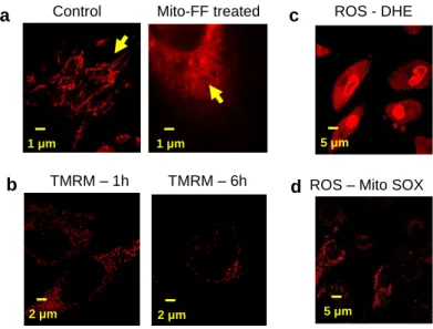 Figure 2-8. (a) Confocal analysis showing mitochondrial shrinkage after Mito-FF treatment on HeLa  cells  (right)  compared  with  control  (left)  (scale  bar,  1  μm)