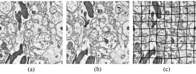 Fig.  1.  An  example  of  EM  image  registration.  (a)  A  fixed  image,  (b)  a  moving  image,  and  (c)  a  warped image of (b) with grid visualization