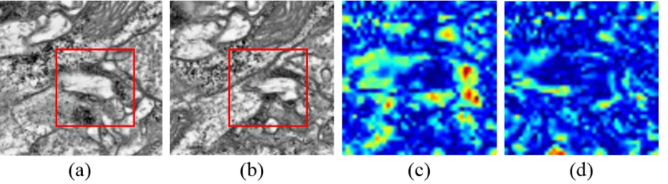 Fig.  3.  Comparison  between  the  pixel  intensity  based  and  the  CAE  feature  based  registration  with  backpropagation