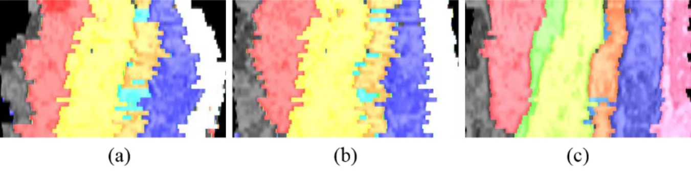 Fig. 7. Vertical view of the alignment result of the randomly deformed CREMI dataset. (a) bUnwarpJ,  (b) elastic stack alignment, and (c) our method