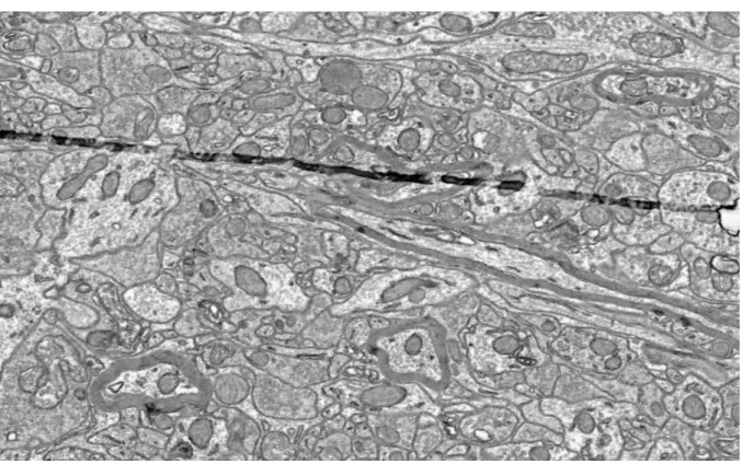 Fig. 8. An example slice of mouse lateral geniculate nucleus dataset with fold artifact