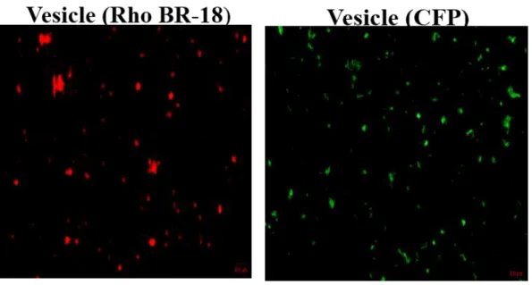 Fig 2.5 Super resolution microscopy (SR-SIM) Image of purified MVs. 2 µg of MVs were stained  with rhodamine BR-18 or 2µg purified MVs from CFP expressing Y