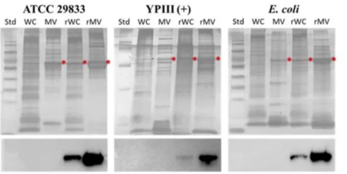 Fig  2.7  Comparative  analysis  of  the  proteins  present  within  the  whole  cells  and  those  in  the  purified MVs