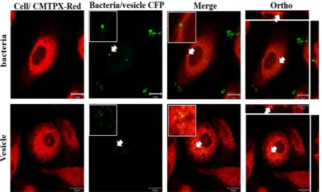 Fig 2.11 Invasion of Yersinia pseudotuberculosis ATCC 29833 MVs into NuLi-1 cells Image shows  localization of Y