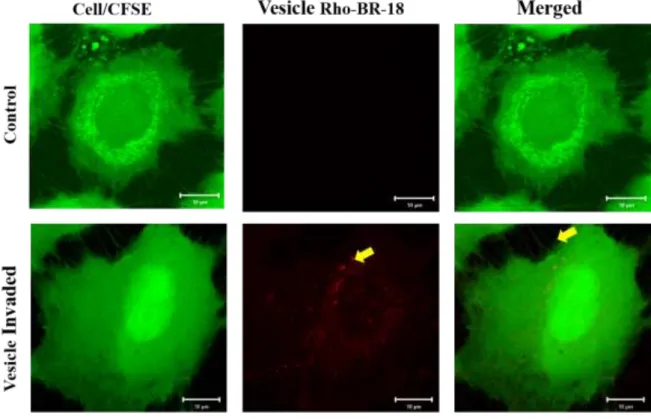 Fig  2.13  Rhodamine  BR-18  labeled  MVs  invaded  into  with  MCF-10a  cells.  Image  shows  localization of Y