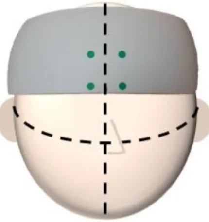 Figure 3. A demonstration of the placement of the fNIRS device 
