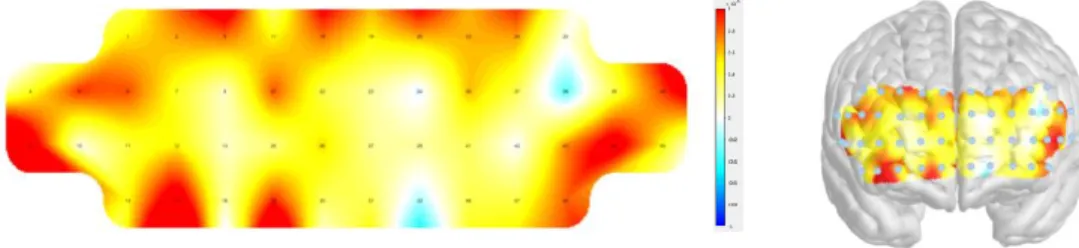 Figure 5. Activation map during the cognitive training. Left, 2D; 