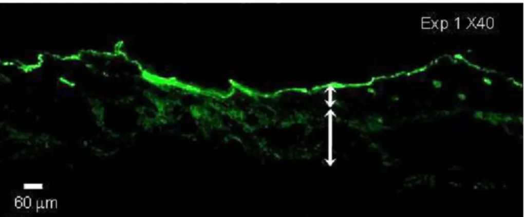 Fig. 3.7. Biotin IHC results showing natural, maximum, and positive staining  results for (a) no control, (b) regular syringe, and (c) micro-jet injection 