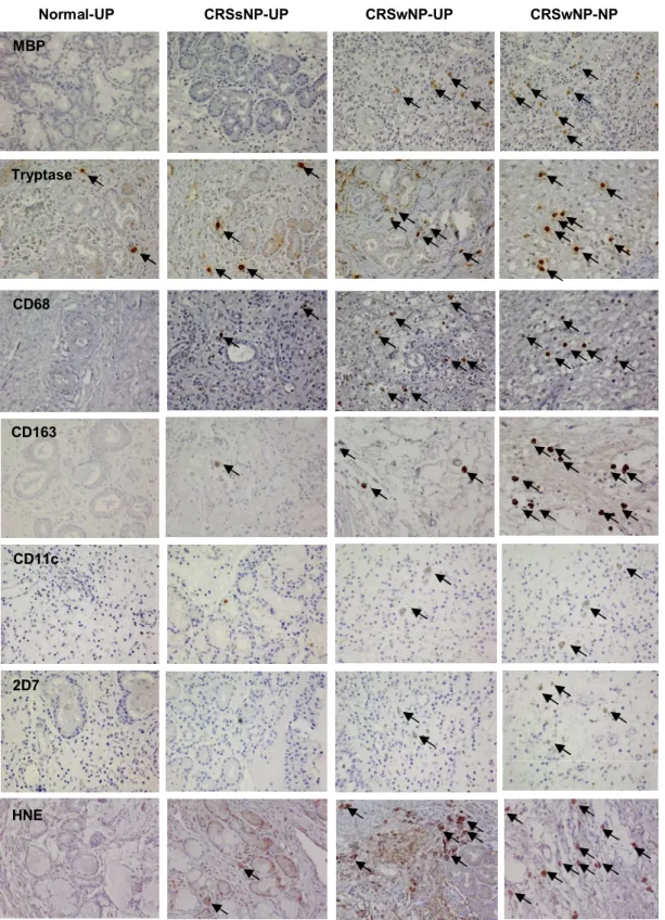 Figure 1. Representative photographs of the immunohistochemical detection of innate immune  cells