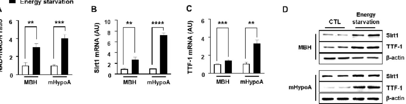 Figure 1. Change of Sirt1 and TTF-1 expression by energy state.   