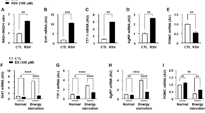 Figure 2. Effect of Sirt1 on the TTF-1 expression and acetylation.   