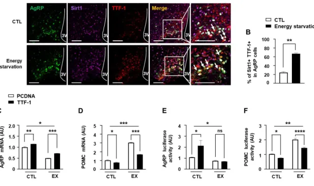 Figure 3. Regulation of AgRP and POMC expression by Sirt1 and TTF-1.   