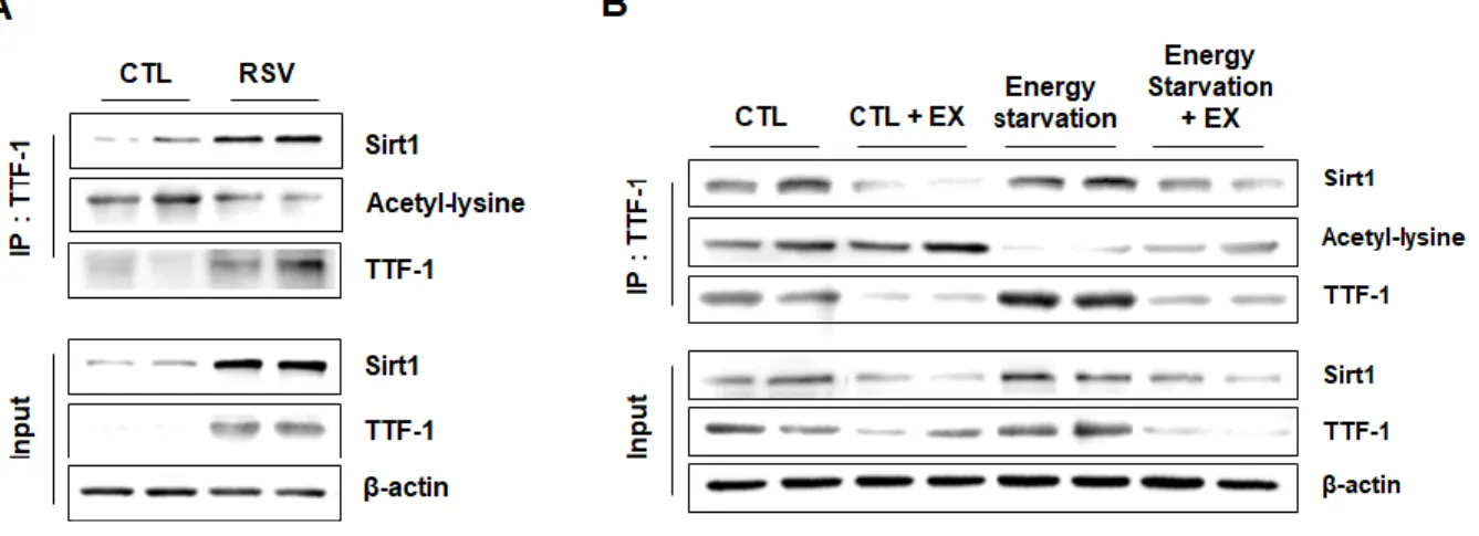Figure  4.  Effect  of  Sirt1  activation  on  interaction  of  TTF-1  with  Sirt1  and  TTF-1  acetylation