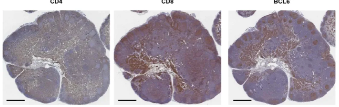 Figure  6.  IHC  staining  of  draining  cervical  LNs  of  4NQO  group  showed  proliferation  of  B  and  T  cell  zones  and  altered  intranodal  anatomy  of  LNs