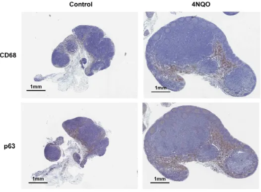 Figure 7. IHC staining of draining cervical LNs showed co-localization of Mfs  and  cancer  cells  in  the  cervical  LNs
