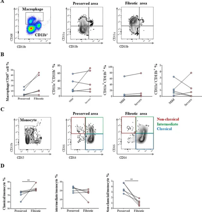 Fig. 2  Monocyte and macrophage subtype changes in IPF patient lungs. A Macrophage gating protocol and dot plots showing lung AM and MoM  distribution in vivo according to CD11c versus CD11b marker expression