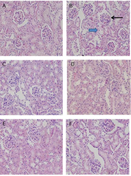 Figure 9. Renal pathologic examination in mice kidney (HE staining). Photomicrograph  of  control  group  (A),  streptozotocin  (STZ)  injected  group  (B),  STZ  with  EGCG  50  mg/kg  treated  group  (C),  STZ  with  EGCG  100  mg/kg  treated  group  (D)