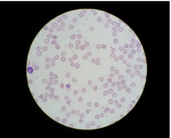 Fig. 1. The picture was captured from peripheral blood smear slide in the  ideal zone by digital camera through an ocular lens