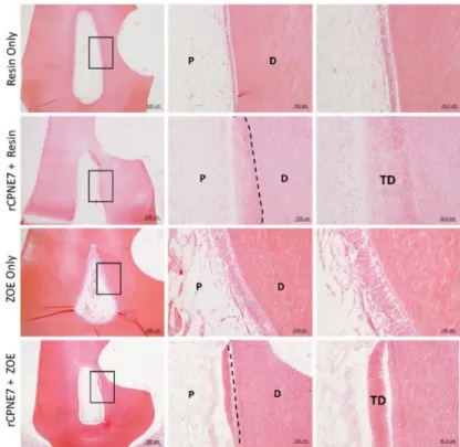 Figure  6.  Tertiary  dentin  formation  is  not  dependent  on  the  restorative  material  used.