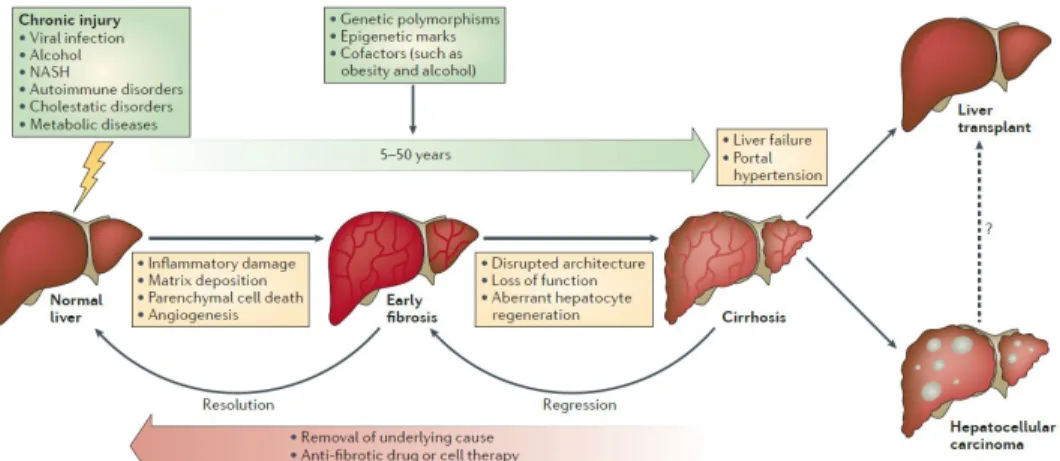 Figure  1.  Development  and  progression  of  liver  fibrosis  (Pellicoro  et  al.  2014)