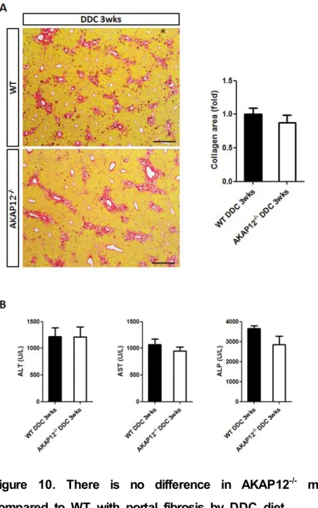 Figure  10.  There  is  no  difference  in  AKAP12 -/-   mouse  liver  compared  to  WT  with  portal  fibrosis  by  DDC  diet