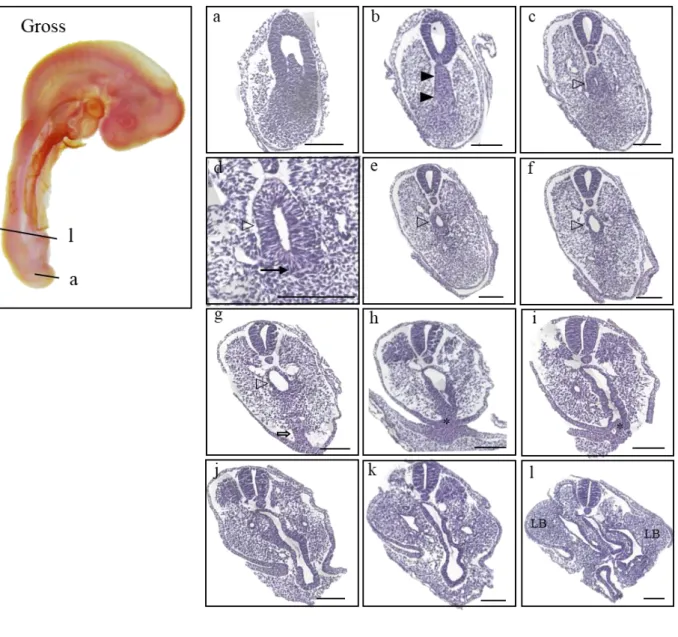 Figure 5. Gross morphology of HH18 embryo presented on the left panel, and the histological sections  listed in a caudal-rostral order (a)-(l)