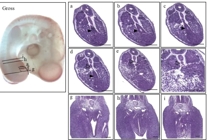 Figure 8. Gross morphology of HH22 embryo presented on the left panel (Gross), and the histological  sections listed in a caudal-rostral order (a)-(i)