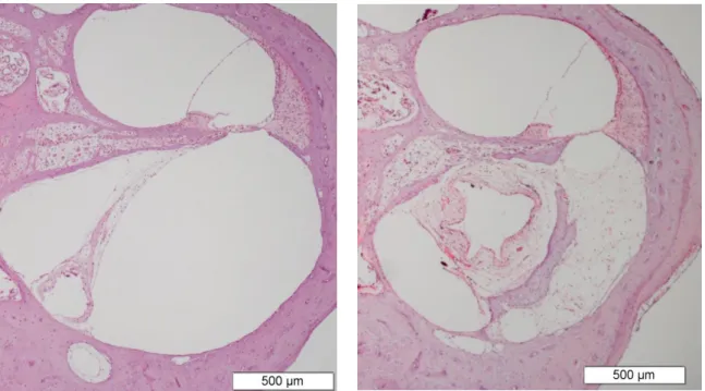 Figure  2.  Tissue  response  in  the  lower  basal  turn  at  12  weeks  after electrode insertion