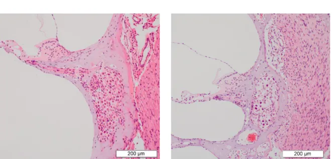 Figure 5. The spiral ganglion cell density of the middle turn at 12  weeks after electrode