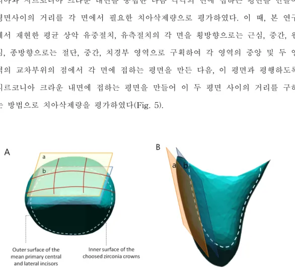Fig. 5. Evaluation of required amount of tooth reduction for restoration of the zirconia crown.