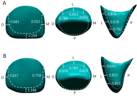 Fig. 7. Mean amount of tooth reduction for restoration of zirconia crown.