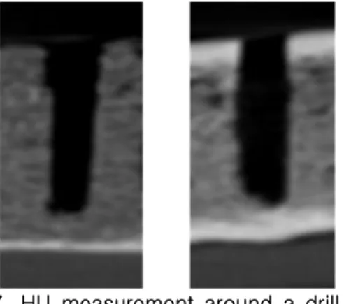 Fig. 7. HU measurement around a drill hole