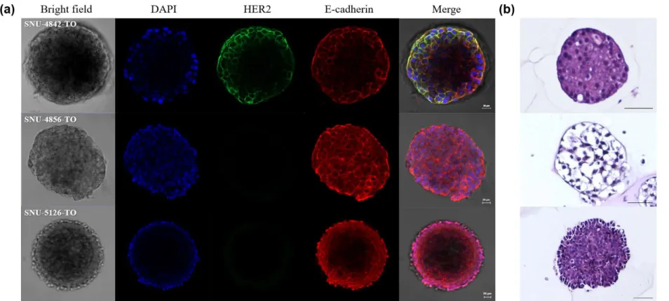 Figure 3. Images of confocal microscope and FFPE H&amp;E staining of 3 organoids derived from PDXT     