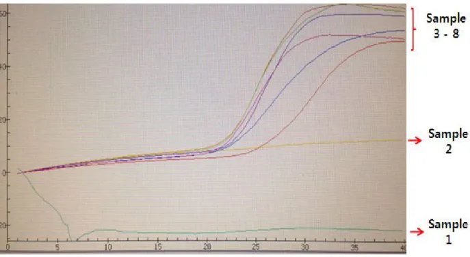 Figure 2. Isothermal amplification of 47 kDa protein gene of Clinical samples (genomic DNA)   