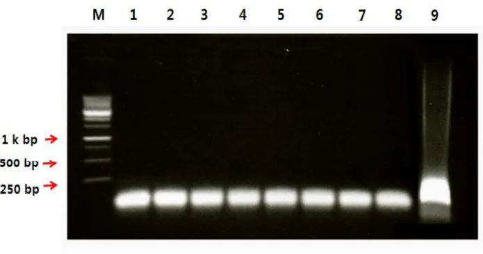 Figure  4.  The  specificity  of  the  47  kDa  protein  gene  loop-mediated  isothermal  amplification  assay  (LAMP)  performed  using #25primers   