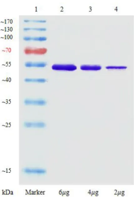 Figure 6. SDS-PAGE of human 15-PGDH. Molecular mass markers are on the lane 1 and the 15-PGDH protein bands are lane 2, 6 µg; lane 3, 4 µg; lane 4, 2 µg