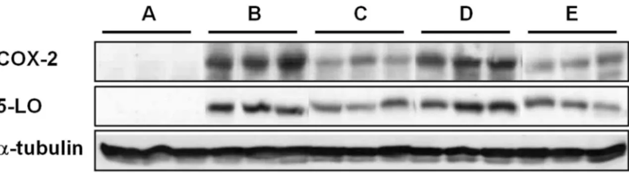 Figure  10.  Western  blot  analysis  of  cyclooxygenase-2  and  5- 5-lipooxygenase expression