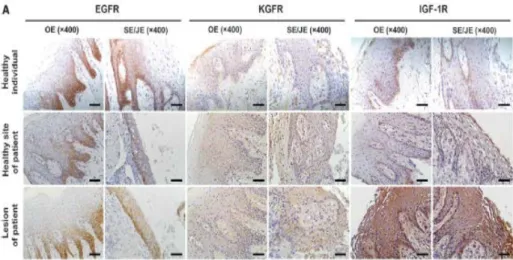 Figure 10. Expression patterns of growth factor receptors in the human  gingival epithelia
